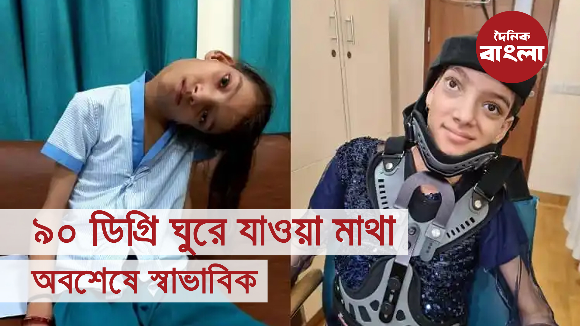 ৯০ ডিগ্রি ঘুরে যাওয়া মাথা, অবশেষে স্বাভাবিক